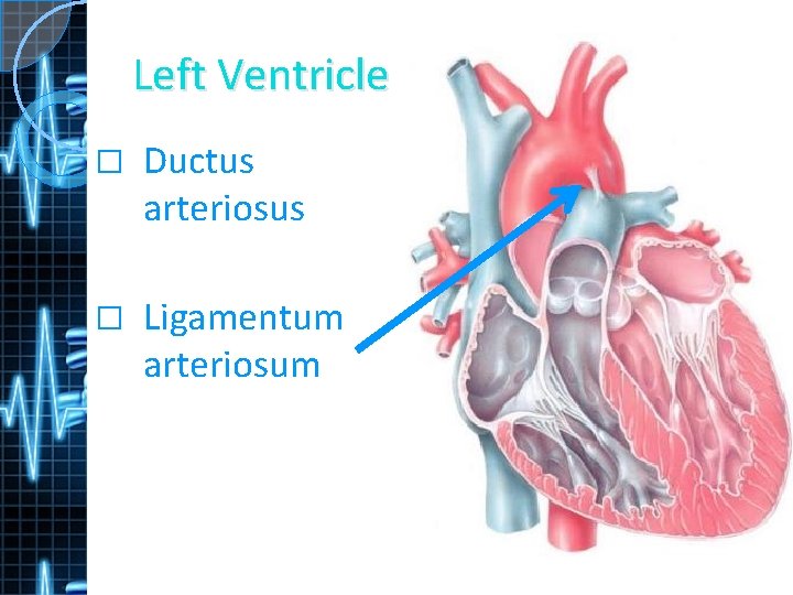 Left Ventricle � Ductus arteriosus � Ligamentum arteriosum 