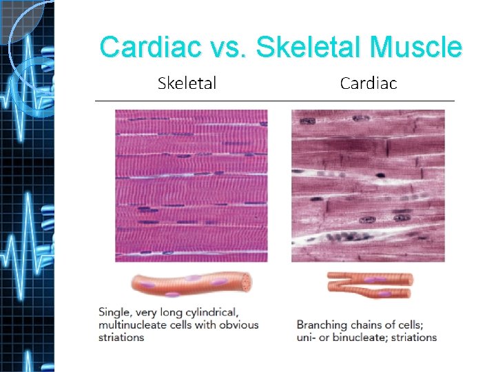 Cardiac vs. Skeletal Muscle 