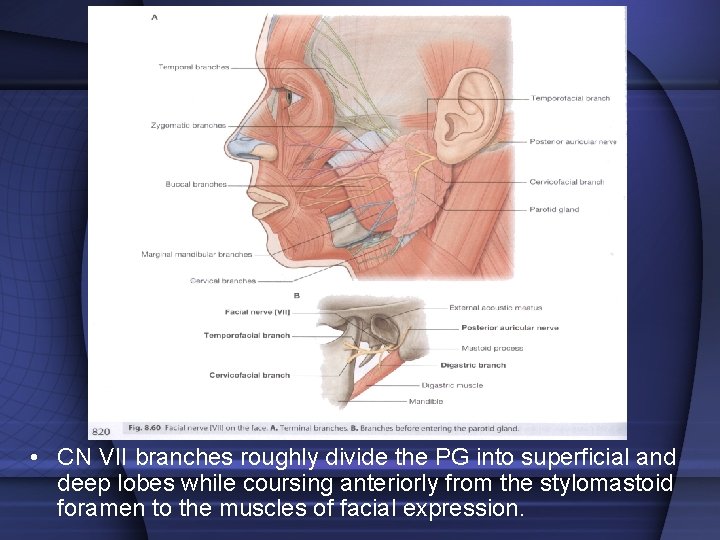  • CN VII branches roughly divide the PG into superficial and deep lobes