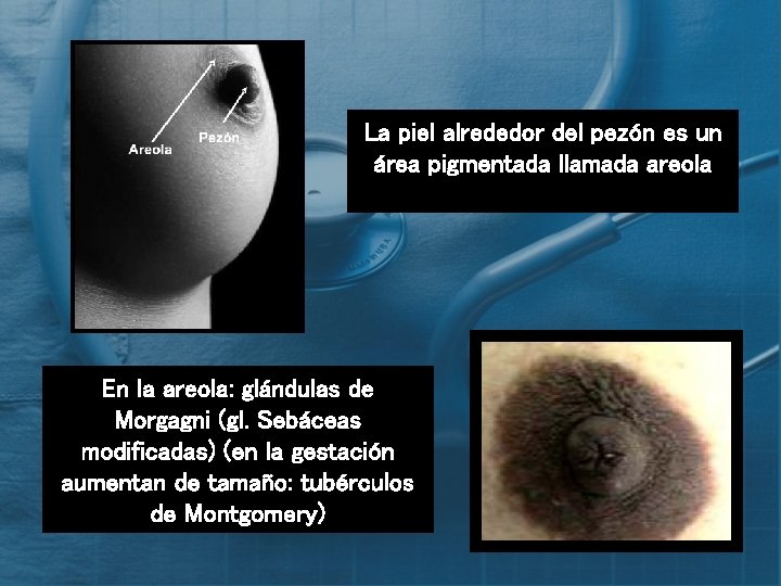 La piel alrededor del pezón es un área pigmentada llamada areola En la areola: