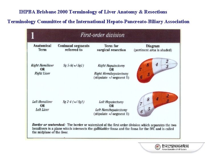 IHPBA Brisbane 2000 Terminology of Liver Anatomy Resections