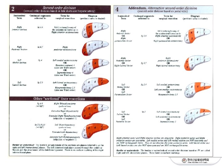 IHPBA Brisbane 2000 Terminology of Liver Anatomy Resections