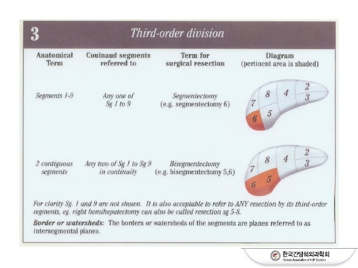 IHPBA Brisbane 2000 Terminology of Liver Anatomy Resections