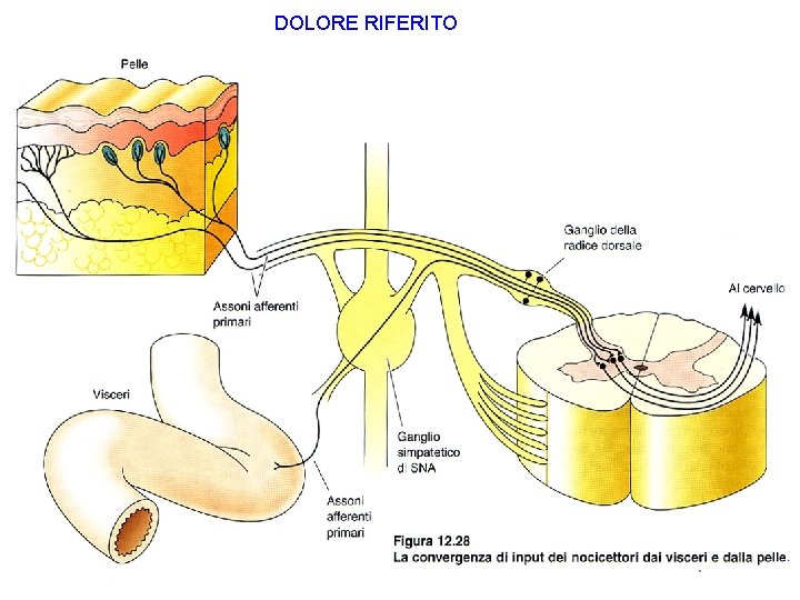DOLORE RIFERITO 