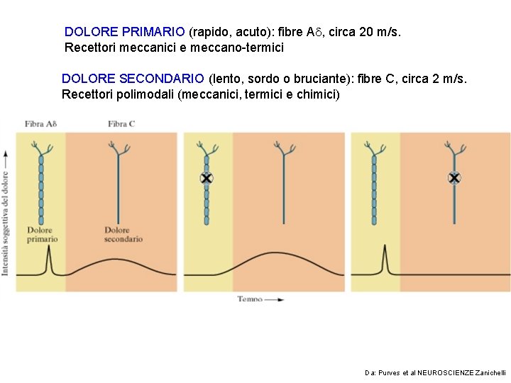 DOLORE PRIMARIO (rapido, acuto): fibre A , circa 20 m/s. Recettori meccanici e meccano-termici