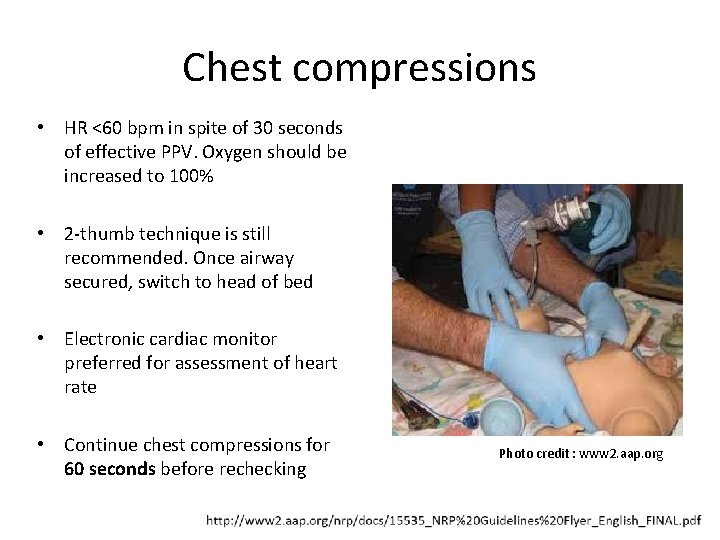 Chest compressions • HR <60 bpm in spite of 30 seconds of effective PPV.