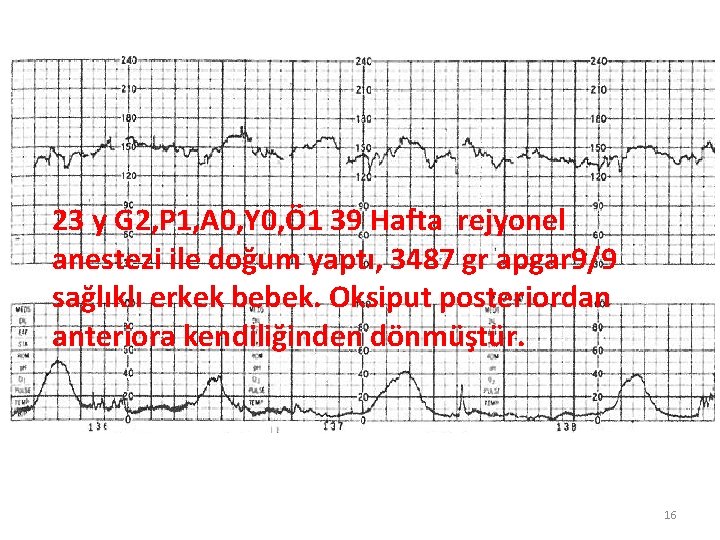 23 y G 2, P 1, A 0, Y 0, Ö 1 39 Hafta