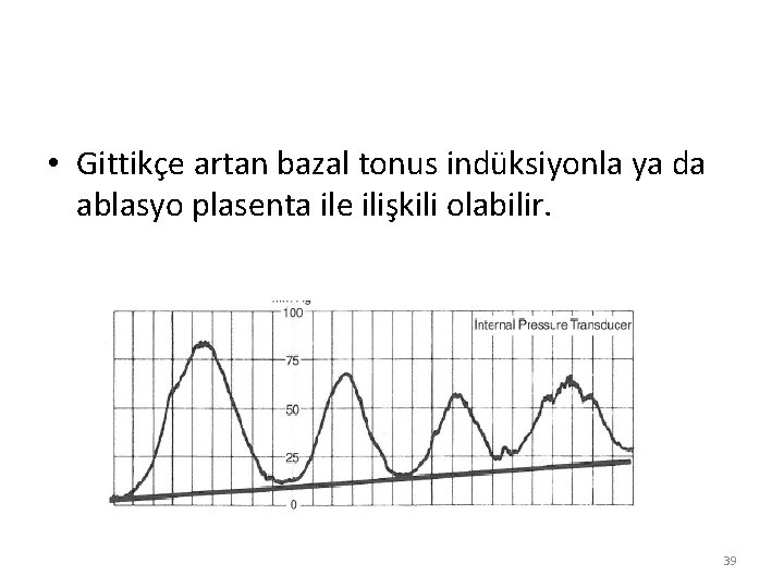  • Gittikçe artan bazal tonus indüksiyonla ya da ablasyo plasenta ile ilişkili olabilir.