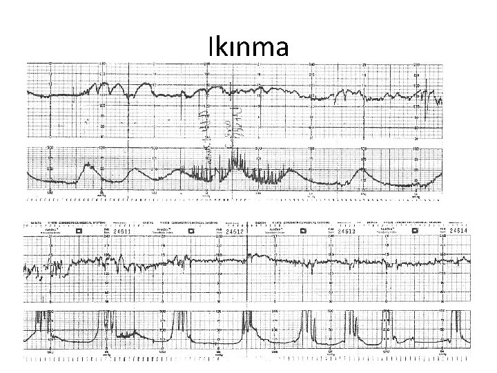 Ikınma 53 