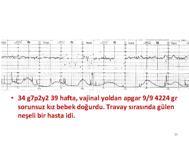  • 34 g 7 p 2 y 2 39 hafta, vajinal yoldan apgar