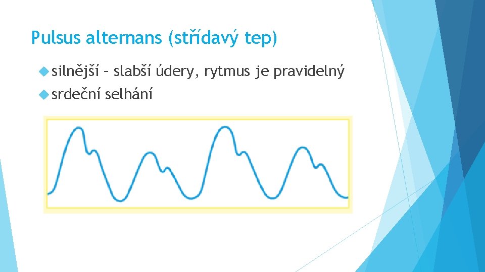 Pulsus alternans (střídavý tep) silnější – slabší údery, rytmus je pravidelný srdeční selhání 