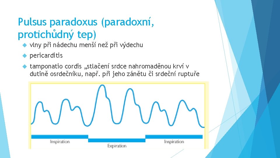 Pulsus paradoxus (paradoxní, protichůdný tep) vlny při nádechu menší než při výdechu pericarditis tamponatio