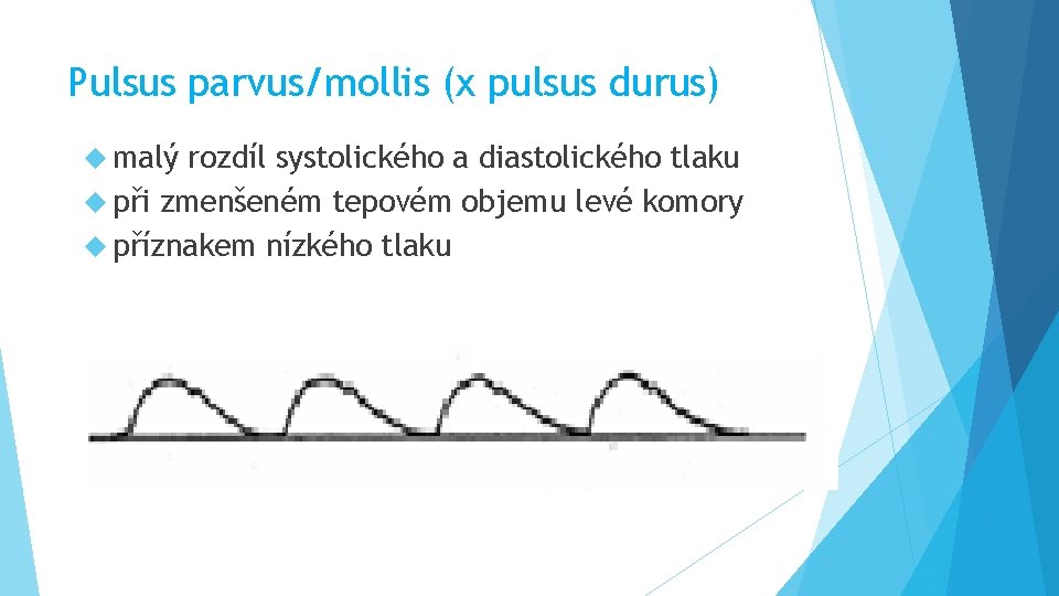 Pulsus parvus/mollis (x pulsus durus) malý rozdíl systolického a diastolického tlaku při zmenšeném tepovém