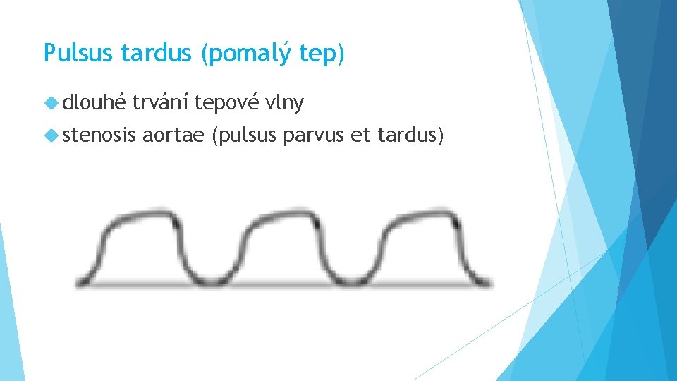 Pulsus tardus (pomalý tep) dlouhé trvání tepové vlny stenosis aortae (pulsus parvus et tardus)