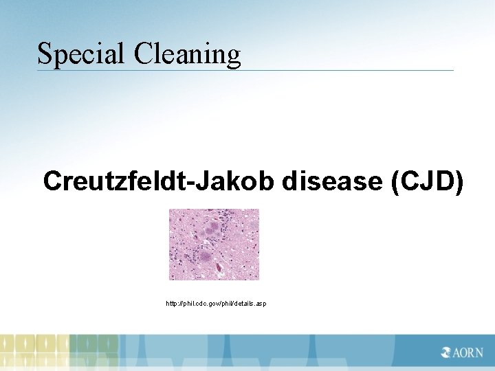 Special Cleaning Creutzfeldt-Jakob disease (CJD) http: //phil. cdc. gov/phil/details. asp 