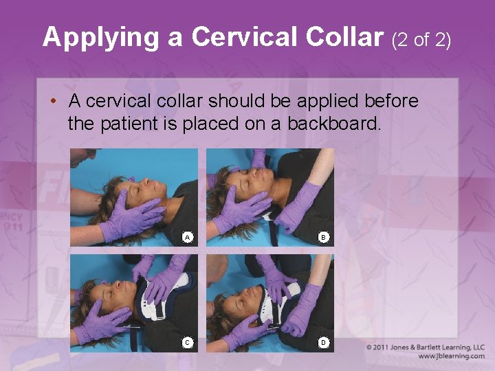 Applying a Cervical Collar (2 of 2) • A cervical collar should be applied