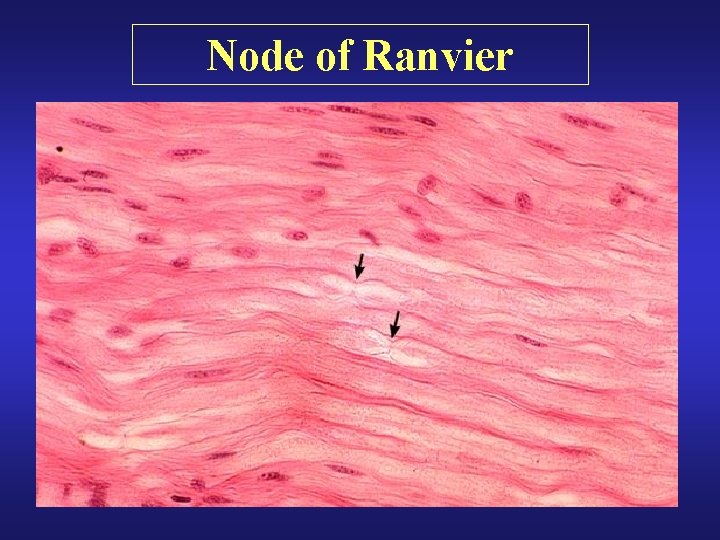 Node of Ranvier 