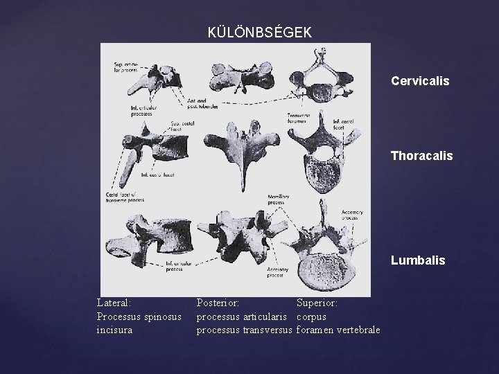 KÜLÖNBSÉGEK Cervicalis Thoracalis Lumbalis Lateral: Processus spinosus incisura Posterior: Superior: processus articularis corpus processus