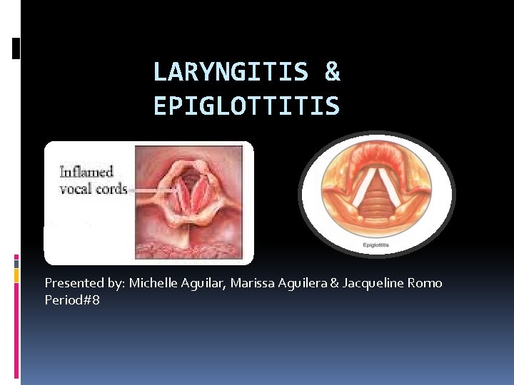 LARYNGITIS & EPIGLOTTITIS Presented by: Michelle Aguilar, Marissa Aguilera & Jacqueline Romo Period#8 