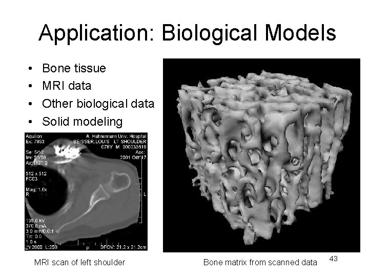 Application: Biological Models • • Bone tissue MRI data Other biological data Solid modeling