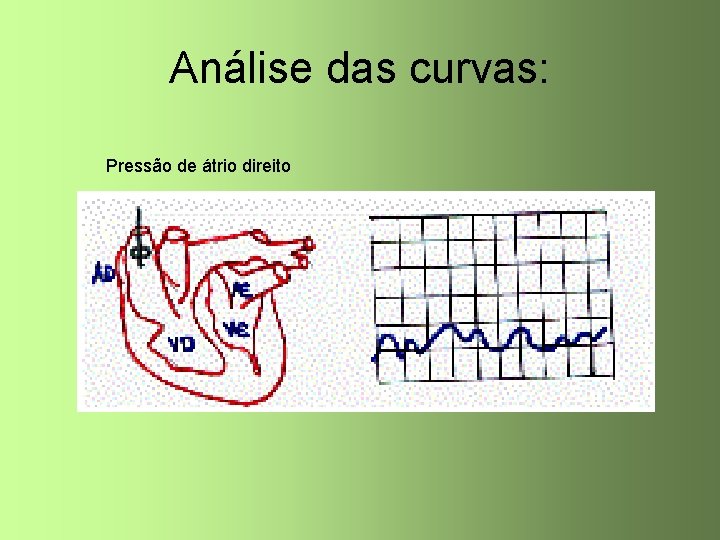 Análise das curvas: Pressão de átrio direito 