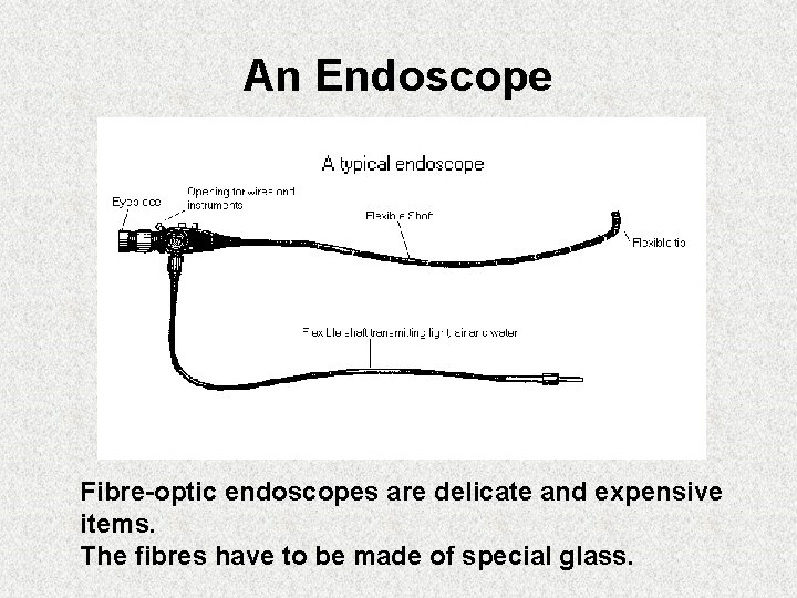 An Endoscope Fibre-optic endoscopes are delicate and expensive items. The fibres have to be An Endoscope Fibre-optic endoscopes are delicate and expensive items. The fibres have to be