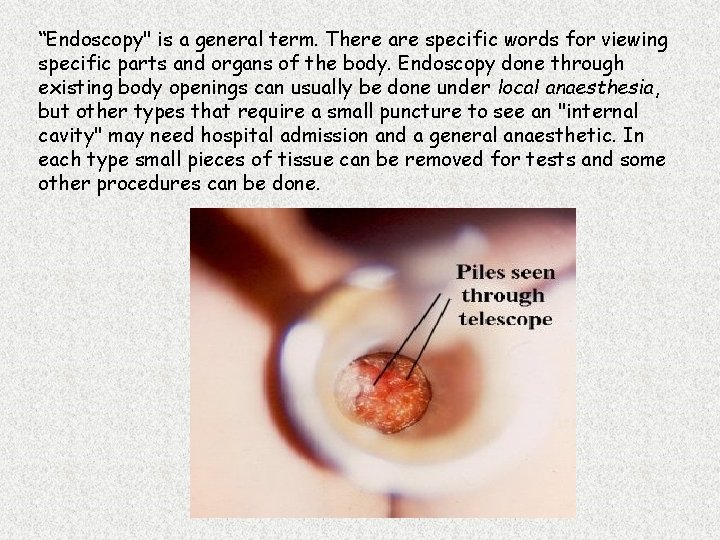 “Endoscopy" is a general term. There are specific words for viewing specific parts and “Endoscopy" is a general term. There are specific words for viewing specific parts and