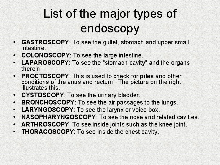 List of the major types of endoscopy • GASTROSCOPY: To see the gullet, stomach List of the major types of endoscopy • GASTROSCOPY: To see the gullet, stomach