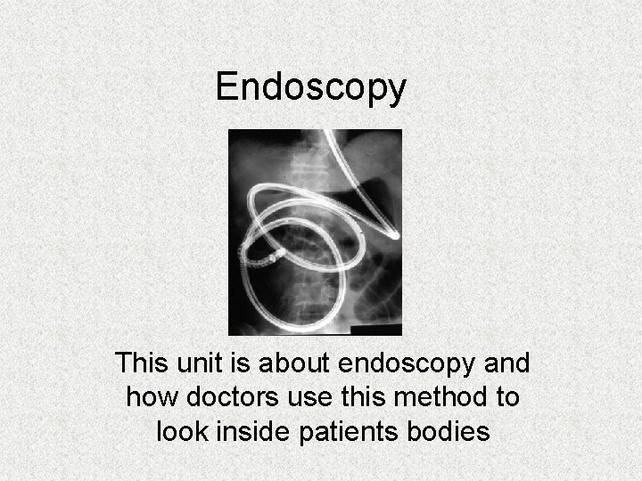 Endoscopy This unit is about endoscopy and how doctors use this method to look Endoscopy This unit is about endoscopy and how doctors use this method to look