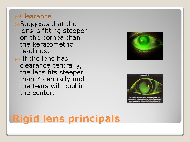  Clearance Suggests that the lens is fitting steeper on the cornea than the