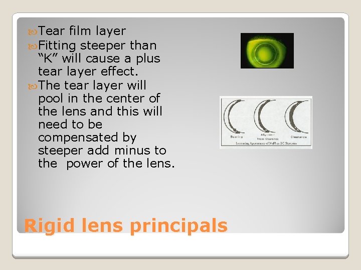  Tear film layer Fitting steeper than “K” will cause a plus tear layer