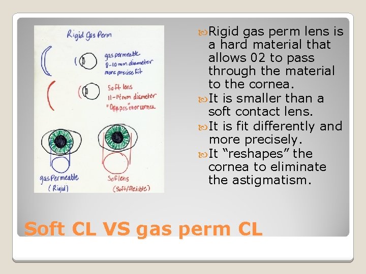  Rigid gas perm lens is a hard material that allows 02 to pass