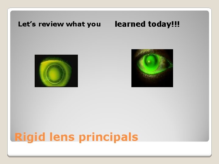 Let’s review what you learned today!!! Rigid lens principals 