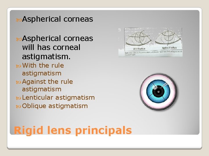  Aspherical corneas will has corneal astigmatism. With the rule astigmatism Against the rule