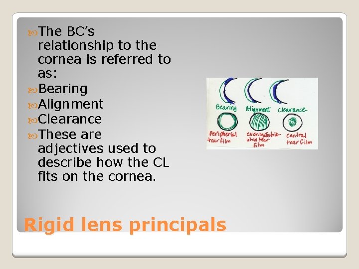 The BC’s relationship to the cornea is referred to as: Bearing Alignment Clearance