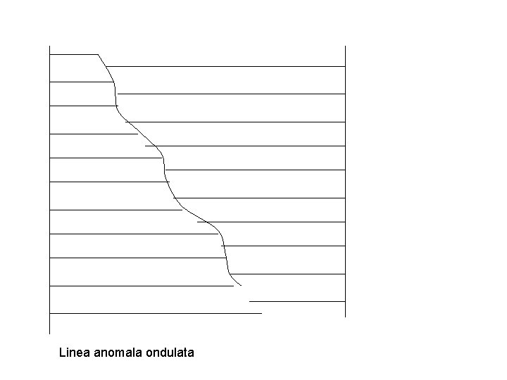 Linea anomala ondulata 