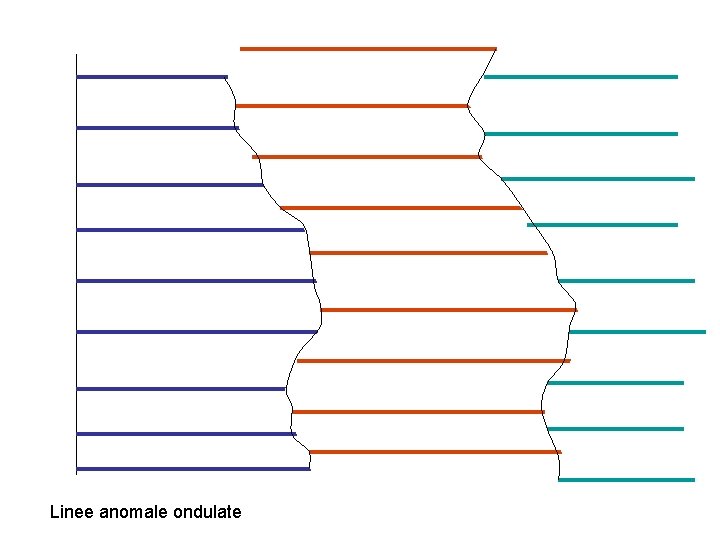 Linee anomale ondulate 