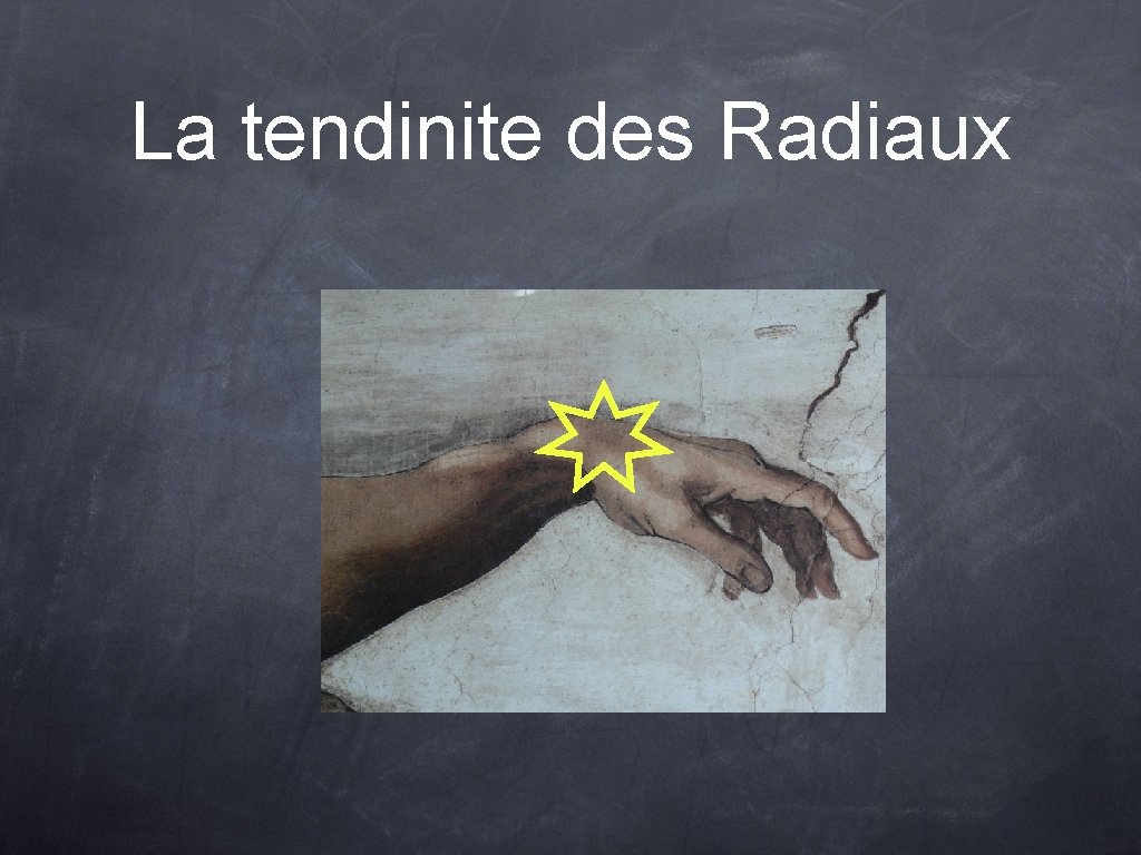 La tendinite des Radiaux 