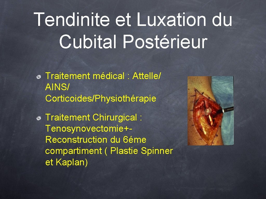 Tendinite et Luxation du Cubital Postérieur Traitement médical : Attelle/ AINS/ Corticoides/Physiothérapie Traitement Chirurgical