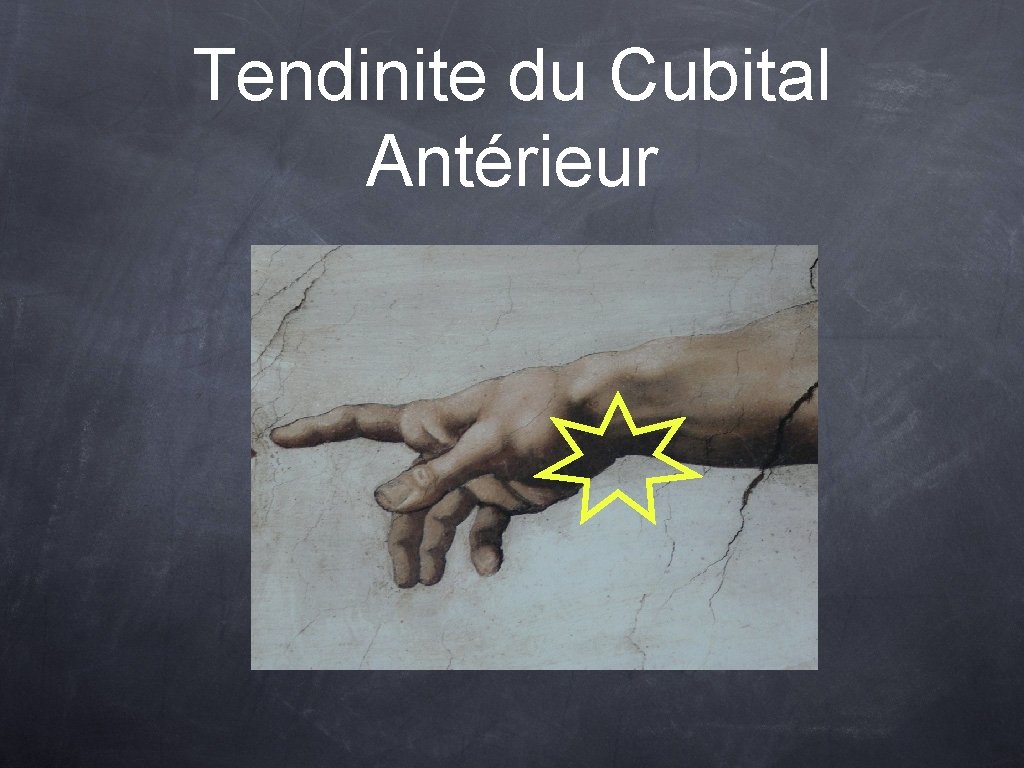 Tendinite du Cubital Antérieur 