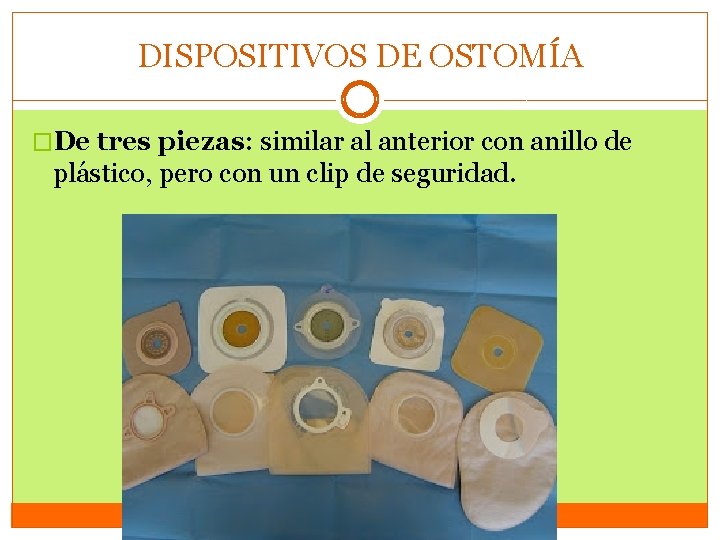 DISPOSITIVOS DE OSTOMÍA �De tres piezas: similar al anterior con anillo de plástico, pero DISPOSITIVOS DE OSTOMÍA �De tres piezas: similar al anterior con anillo de plástico, pero