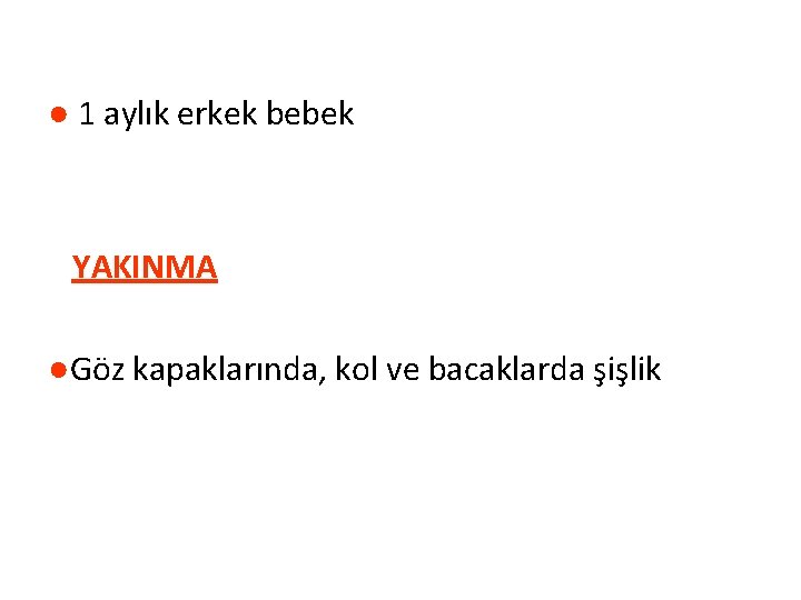 ● 1 aylık erkek bebek YAKINMA ●Göz kapaklarında, kol ve bacaklarda şişlik 