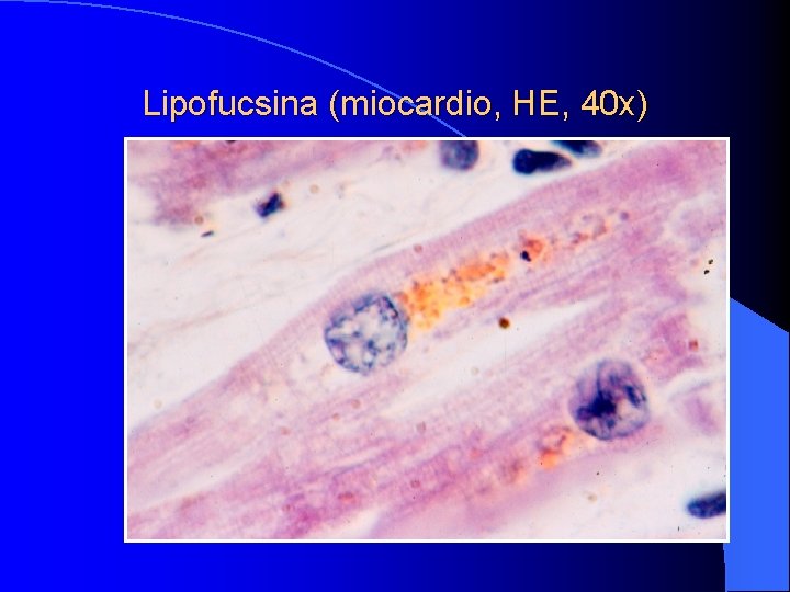 Lipofucsina (miocardio, HE, 40 x) 