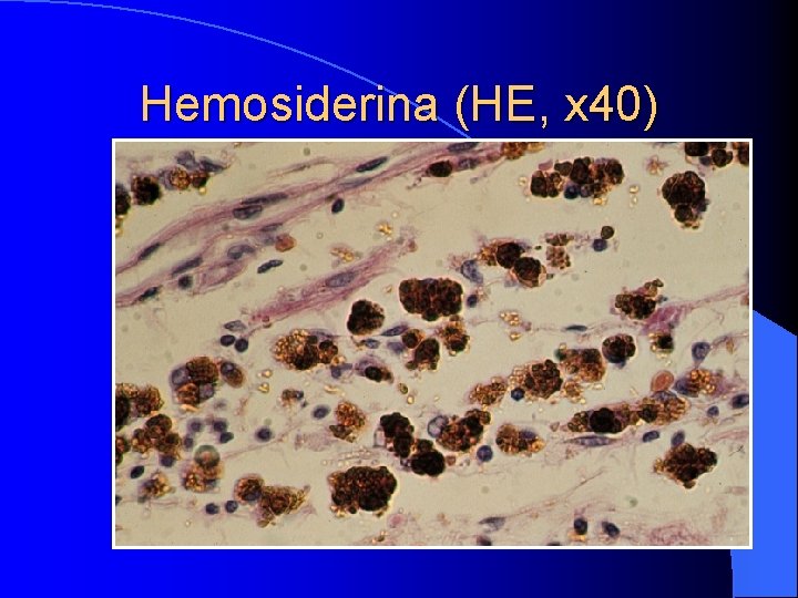 Hemosiderina (HE, x 40) 