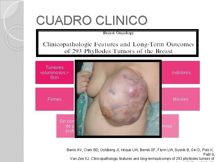 CUADRO CLINICO Tumores voluminosos > 5 cm Crecimiento rápido 20 -30% 2/10 tumores no