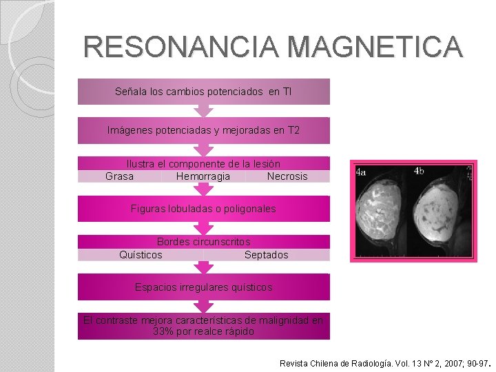 RESONANCIA MAGNETICA Señala los cambios potenciados en TI Imágenes potenciadas y mejoradas en T