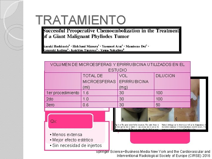 TRATAMIENTO VOLUMEN MICROESFERAS Y EPIRRUBICINA UTILIZADOS EN EL 37 DE años ESTUDIO Conclusiones: VOL