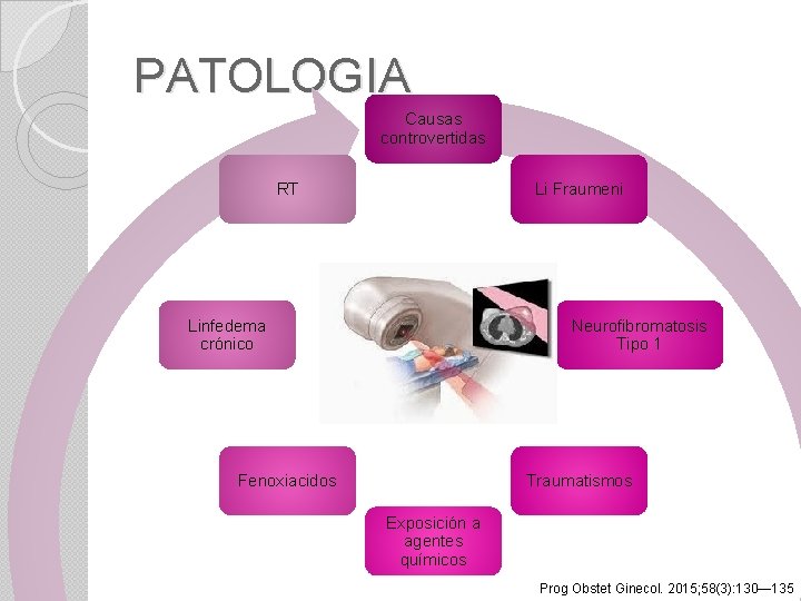 PATOLOGIA Causas controvertidas RT Li Fraumeni Linfedema crónico Neurofibromatosis Tipo 1 Fenoxiacidos Traumatismos Exposición