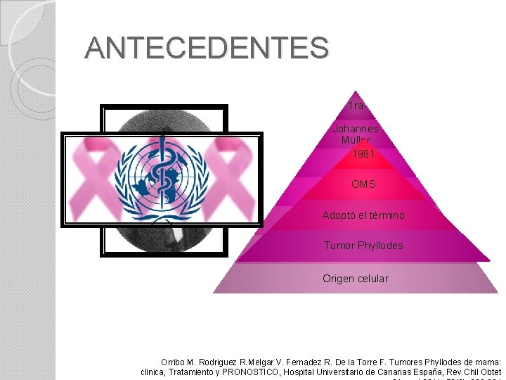 ANTECEDENTES 1 ra Johannes Müller 1981 1838 OMS Cistosarcoma Phyllodes En desuso porelque no