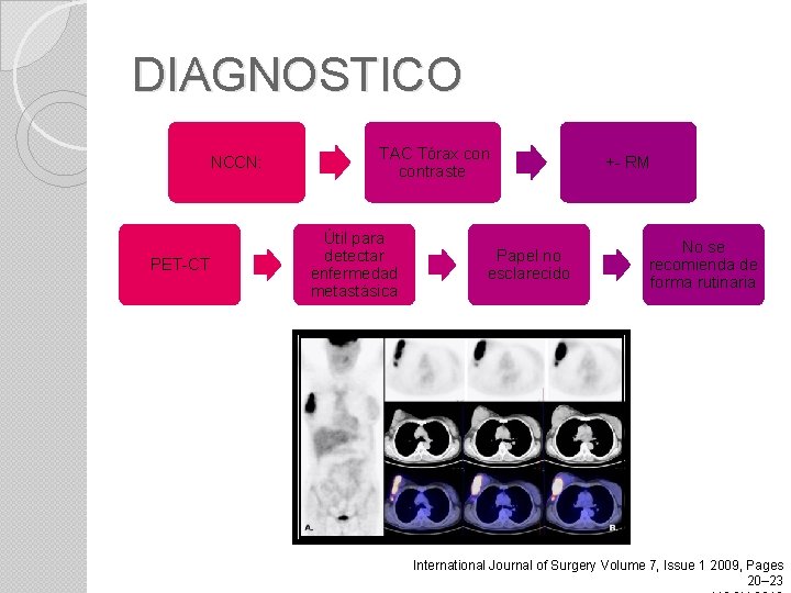 DIAGNOSTICO NCCN: PET-CT TAC Tórax contraste Útil para detectar enfermedad metastásica Papel no esclarecido